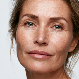 Mature Skin, Fine Lines & Wrinkles