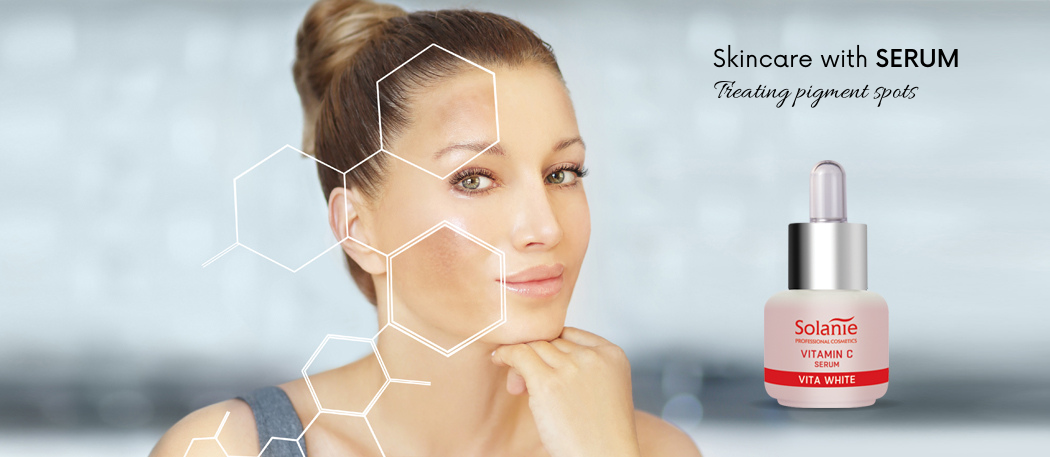 What can you do against pigment spots?