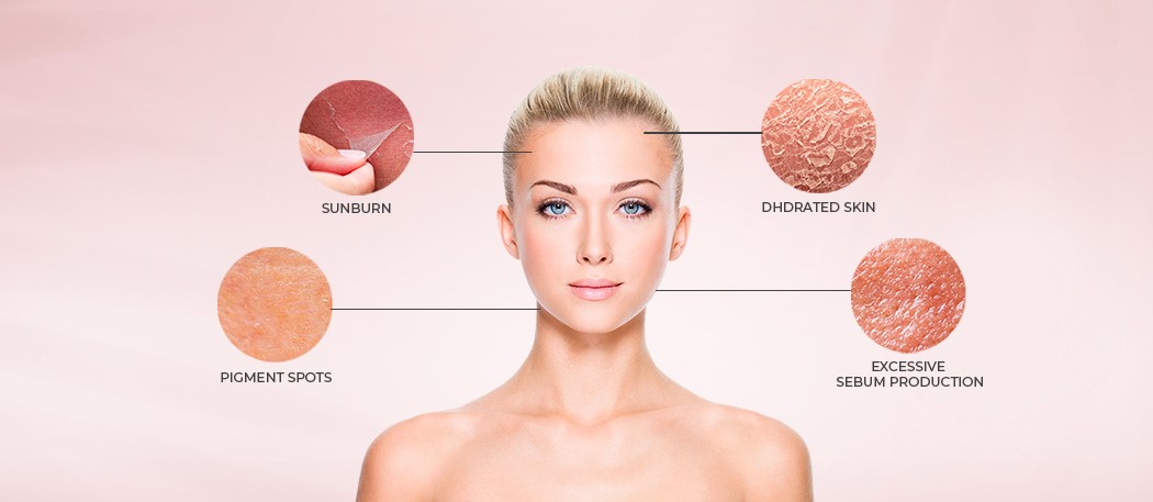 SUMMER SKIN CARE: ISSUES AND SOLUTIONS